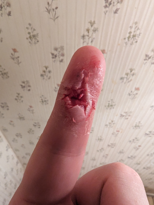 finger.png