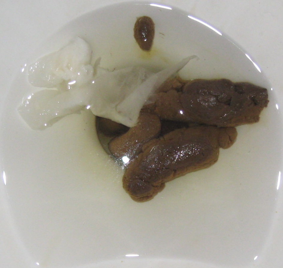 Human_feces_in_toilet.jpg